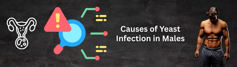 Causes of Yeast Infection in Males